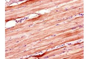Immunohistochemistry of paraffin-embedded human skeletal muscle tissue using ABIN7176655 at dilution of 1:100 (ZSWIM6 Antikörper  (AA 430-583))