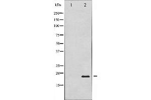 Western blot analysis of Pin1 expression in COS7 whole cell lysates,The lane on the left is treated with the antigen-specific peptide. (PIN1 Antikörper)