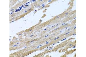 Immunohistochemistry of paraffin-embedded Rat heart using NSF Polyclonal Antibody at dilution of 1:100 (40x lens). (NSF Antikörper)