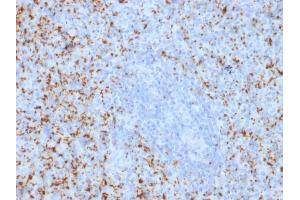 Formalin-fixed, paraffin-embedded human Spleen stained with CD61 Mouse Monoclonal Antibody (ITGB3/2145). (Integrin beta 3 Antikörper  (AA 385-490))