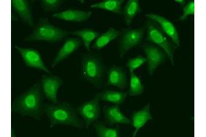 Immunofluorescence analysis of HeLa cell using TREX1 antibody. (TREX1 Antikörper)
