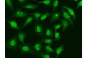 Immunofluorescence analysis of HeLa cell using TREX1 antibody.