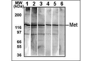Western Blotting (WB) image for anti-Met Proto-Oncogene (MET) (pTyr1234), (pTyr1235) antibody (ABIN356338) (c-MET Antikörper  (pTyr1234, pTyr1235))