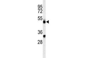Western blot analysis of CFP antibody and CEM lysate. (CFP Antikörper  (AA 197-223))