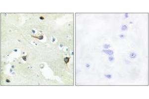 Immunohistochemistry analysis of paraffin-embedded human brain tissue, using EPHB1/2/3 Antibody. (EPH Receptor B1/2/3 (AA 631-680) Antikörper)