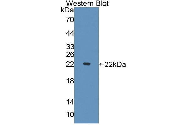 PHF8 antibody  (AA 195-351)