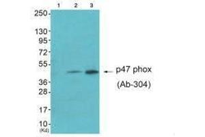 Western blot analysis of extracts from HepG2 cells (Lane 2) and Jurket cells (Lane 3), using Neutrophil Cytosol Factor 1 (Ab-304) antiobdy. (NCF1 Antikörper  (Ser304))