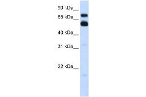 WB Suggested Anti-VISA Antibody Titration:  0. (MAVS Antikörper  (C-Term))