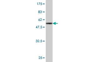 Western Blot detection against Immunogen (55. (GCLM Antikörper  (AA 1-274))