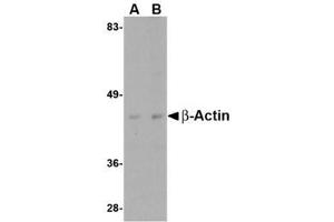Image no. 1 for anti-Actin, beta (ACTB) (C-Term) antibody (ABIN341734) (beta Actin Antikörper  (C-Term))