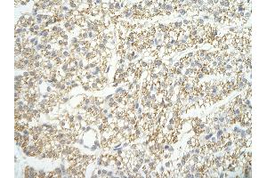 Rabbit Anti-LSM4 antibody   Paraffin Embedded Tissue: Human Heart cell Cellular Data: cardiac cell of renal tubule Antibody Concentration: 4. (LSM4 Antikörper  (Middle Region))