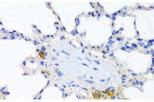 Immunohistochemistry of paraffin-embedded Rat lung using ITGAX Polyclonal Antibody at dilution of 1:100 (40x lens). (CD11c Antikörper)