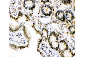 Immunohistochemistry (IHC) image for anti-Ubiquitin (Ub) (AA 77-152) antibody (ABIN3029418)