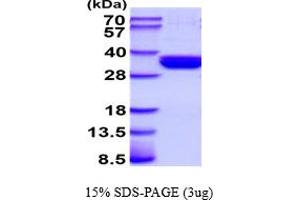 SDS-PAGE (SDS) image for CD207 Molecule, Langerin (CD207) (AA 65-328) protein (His tag) (ABIN5854553)