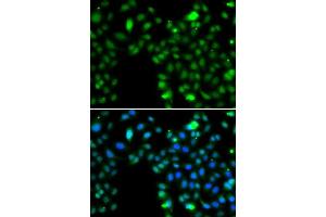 Immunofluorescence analysis of MCF-7 cells using ING5 antibody.