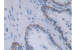 Immunohistochemistry (IHC) image for anti-Tumor Necrosis Factor (Ligand) Superfamily, Member 9 (TNFSF9) (AA 42-253) antibody (ABIN7441109)