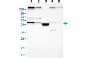 Western blot analysis of Lane 1: RT-4, Lane 2: U-251 MG, Lane 3: Human Plasma, Lane 4: Liver, Lane 5: Tonsil with FAM134C polyclonal antibody  at 1:250-1:500 dilution.