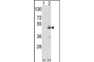 Western blot analysis of PKM2 (arrow) using rabbit polyclonal PKM2 Antibody (N-term ) (ABIN653018 and ABIN2842641). (PKM2 Antikörper  (N-Term))