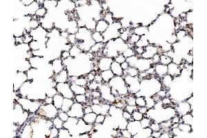 IHC analysis of Galectin 3/LGALS3 using anti-Galectin 3/LGALS3 antibody (ABIN3043400). (Galectin 3 Antikörper  (AA 153-264))