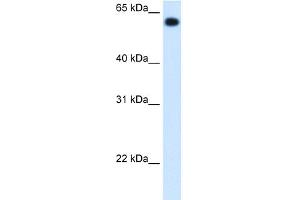 WB Suggested Anti-ALDH4A1 Antibody Titration:  1. (ALDH4A1 Antikörper  (C-Term))