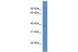 Western Blot showing AKR1D1 antibody used at a concentration of 1 ug/ml against RPMI-8226 Cell Lysate (AKR1D1 Antikörper  (Middle Region))