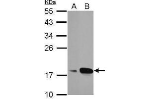 WB Image Sample (30 ug of whole cell lysate) A: A549 B: MCF-7 12% SDS PAGE antibody diluted at 1:1000 (AGR3 Antikörper  (Center))