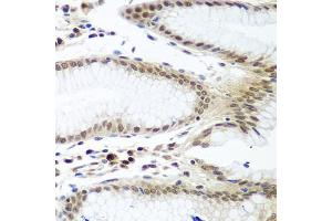 Immunohistochemistry of paraffin-embedded human stomach using PTTG1 antibody (ABIN5974823) at dilution of 1/100 (40x lens). (PTTG1 Antikörper)