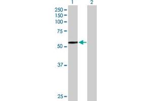 Western Blot analysis of HEXA expression in transfected 293T cell line by HEXA MaxPab polyclonal antibody. (Hexosaminidase A Antikörper  (AA 1-529))