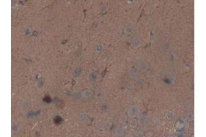 Immunohistochemistry (IHC) image for anti-Thrombospondin 1 (THBS1) (AA 71-259) antibody (ABIN7432190)