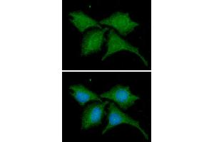 ICC/IF analysis of B2M in HeLa cells line, stained with DAPI (Blue) for nucleus staining and monoclonal anti-human B2M antibody (1:100) with goat anti-mouse IgG-Alexa fluor 488 conjugate (Green).