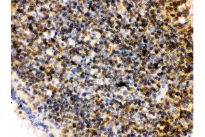 Anti- PLK1 Picoband antibody,IHC(P) IHC(P): Rat Lymphaden Tissue