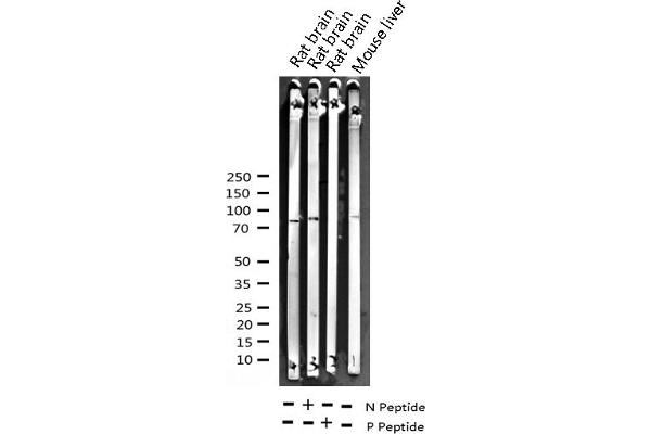 PKC delta Antikörper  (pTyr313)