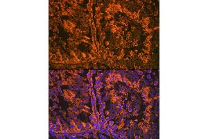 Immunofluorescence analysis of mouse testis using SRD5 Rabbit mAb (ABIN7270595) at dilution of 1:100 (40x lens). (SRD5A2 Antikörper)