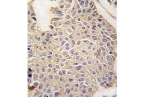 Image no. 3 for anti-Microtubule-Associated Protein 2 (MAP2) (C-Term) antibody (ABIN357399) (MAP2 Antikörper  (C-Term))