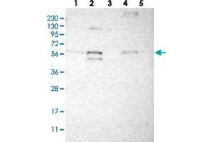 Western blot analysis of Lane 1: RT-4, Lane 2: U-251 MG, Lane 3: Human Plasma, Lane 4: Liver, Lane 5: Tonsil with C1orf27 polyclonal antibody  at 1:250-1:500 dilution.