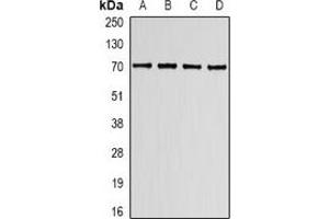 Western blot analysis of Lamin B Receptor expression in K562 (A), HT29 (B), mouse spleen (C), mouse lung (D) whole cell lysates.