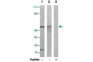Western blot analysis of extracts from K-562 cells (Lane 1) and NIH/3T3 cells (Lane 2 and 3), using CAMK2A/CAMK2D polyclonal antibody . (CAMK2A Antikörper)