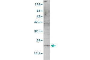HSPC163 monoclonal antibody (M01), clone 4E10-1G4 Western Blot analysis of HSPC163 expression in A-431 .