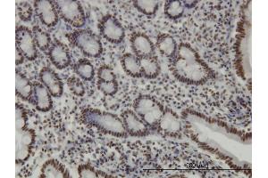 Immunoperoxidase of monoclonal antibody to TRIM28 on formalin-fixed paraffin-embedded human small Intestine. (KAP1 Antikörper  (AA 379-524))