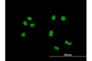 Immunofluorescence of purified MaxPab antibody to RASSF8 on HeLa cell.