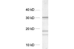 dilution: 1 : 5000, sample: crude synaptosomal fraction of rat brain (P2) (Clathrin Antikörper  (AA 156-173))
