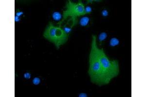 Anti-MTMR14 mouse monoclonal antibody (ABIN2453332) immunofluorescent staining of COS7 cells transiently transfected by pCMV6-ENTRY MTMR14 (RC207732). (MTMR14 Antikörper)