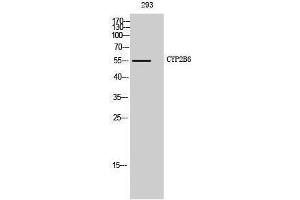 Western Blotting (WB) image for anti-Cytochrome P450, Family 2, Subfamily B, Polypeptide 6 (CYP2B6) (Internal Region) antibody (ABIN3184175) (CYP2B6 Antikörper  (Internal Region))