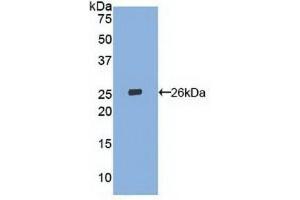 Detection of Recombinant LOX1, Human using Polyclonal Antibody to Lectin Like Oxidized Low Density Lipoprotein Receptor 1 (LOX1) (OLR1 Antikörper  (AA 81-273))