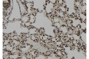 ABIN6273097 at 1/100 staining Rat lung tissue by IHC-P.
