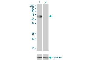 Western blot analysis of BMPR1B over-expressed 293 cell line, cotransfected with BMPR1B Validated Chimera RNAi (Lane 2) or non-transfected control (Lane 1). (BMPR1B Antikörper  (AA 14-502))