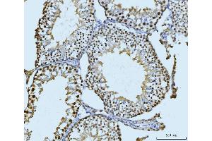IHC analysis of SBNO1 using anti-SBNO1 antibody (ABIN7601710). (SBNO1 Antikörper  (AA 43-1303))