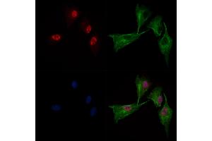 ABIN6262179 and ABIN6269054 staining  cells by IF/ICC.