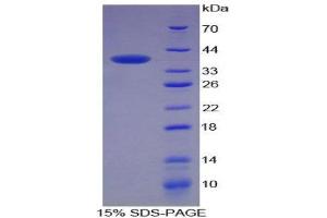 SDS-PAGE (SDS) image for Keratin 4 (KRT4) (AA 152-457) protein (His tag) (ABIN2125562) (KRT4 Protein (AA 152-457) (His tag))