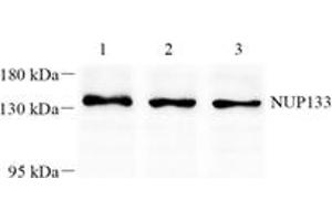 Western blot analysis of NUP133 (ABIN7074909) at dilution of 1: 1000,Lane 1: K562 cell lysate,Lane 2: 293 cell lysate,Lane 3: A375 cell lysate (NUP133 Antikörper)